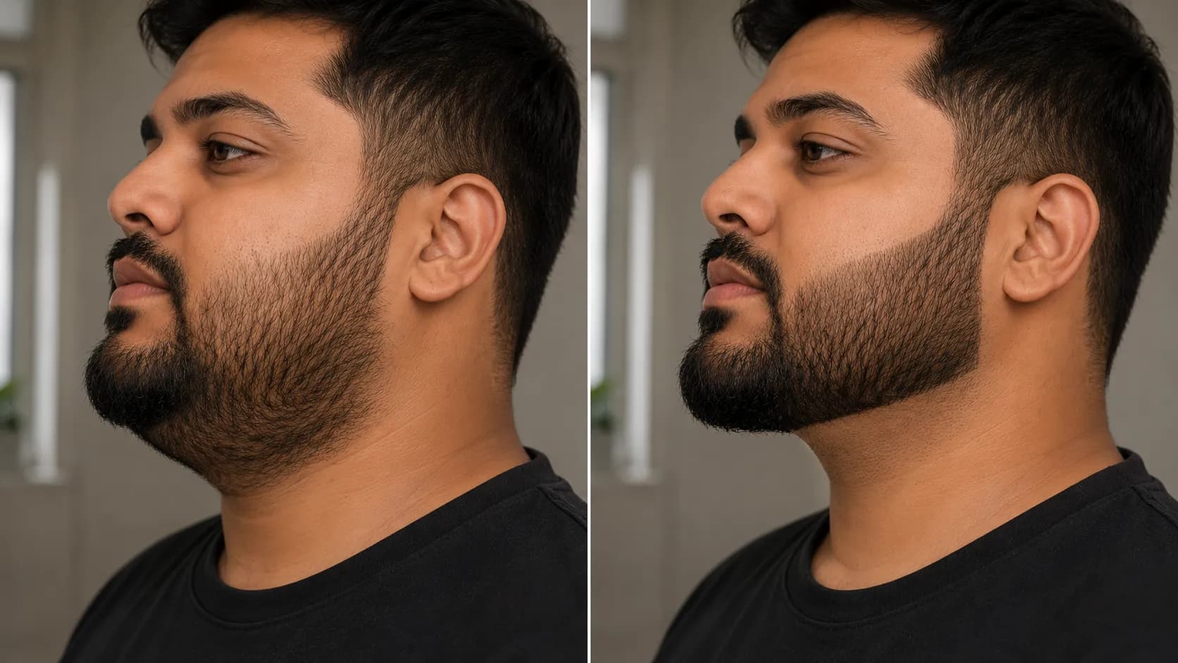 Before-and-after comparison of beard neckline shaping showing a high rounded neckline versus a lower 45-degree neckline that creates a sharper jawline and reduces the appearance of a double chin.
