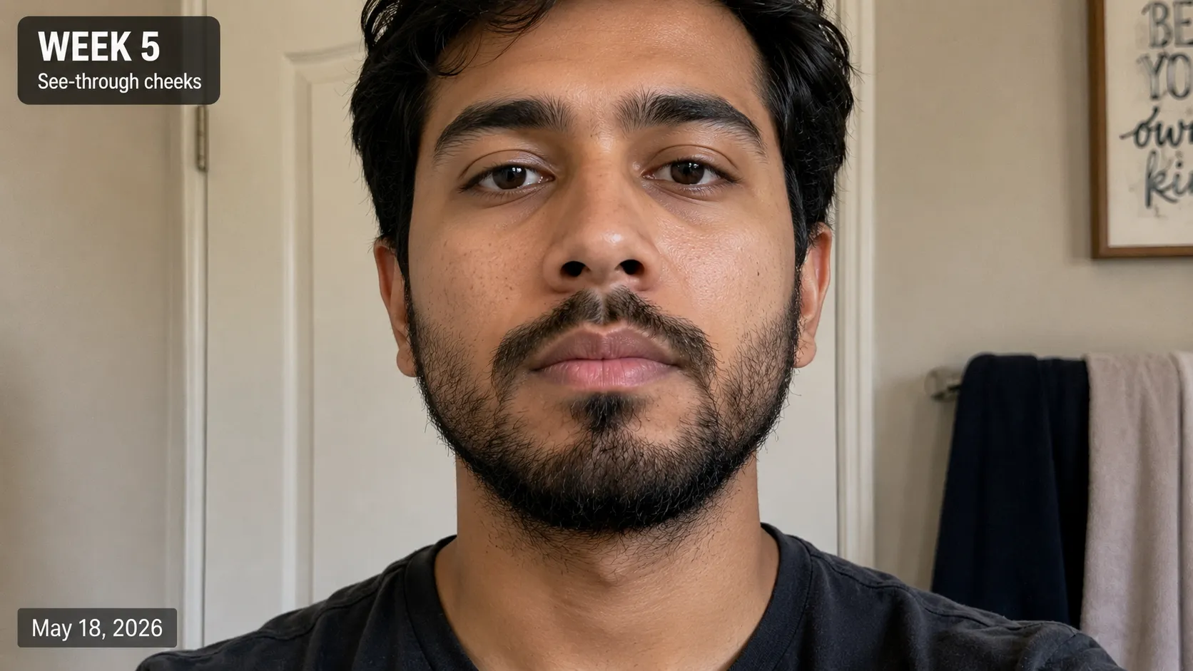 Week 5 beard growth progress photo showing patchy, see-through cheeks with a fuller chin, illustrating the common awkward beard growth phase before fuller coverage develops.