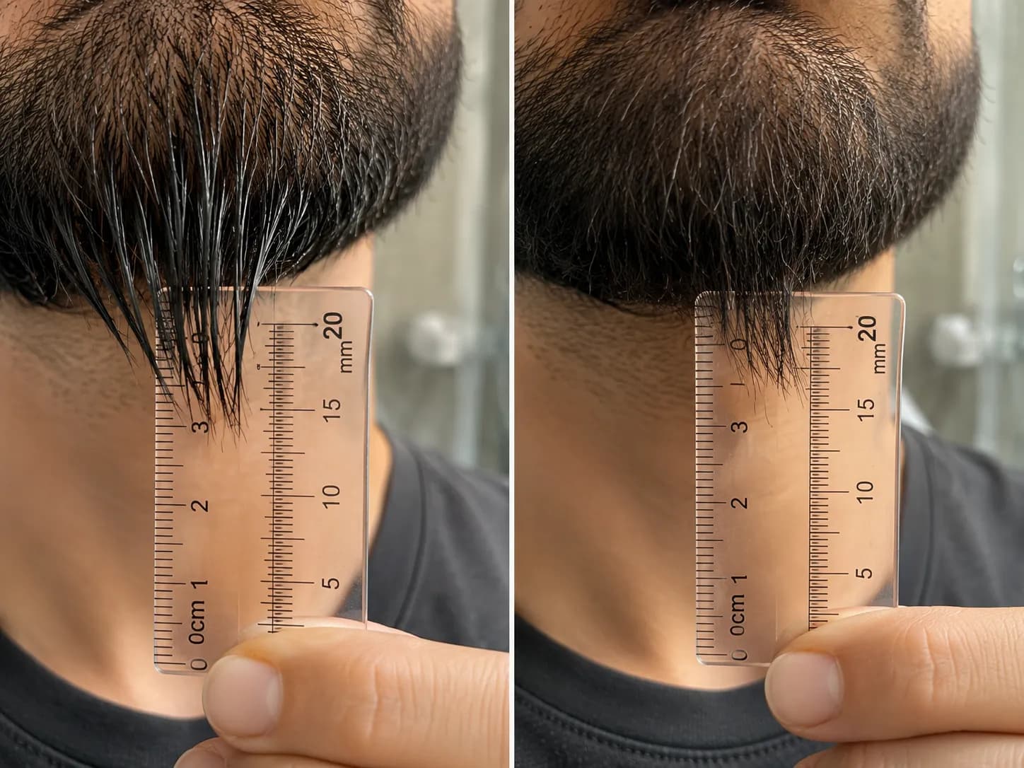Side-by-side comparison of wet and dry chin beard hair measured with a clear ruler, showing about 18 mm when wet and 14 mm after drying before trimming.